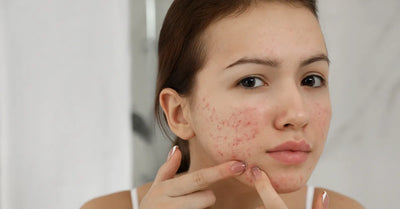 Jeune femme avec peau mixte touchée par l'acné et des rougeurs, examinant ses imperfections sur la zone T, dans une salle de bain