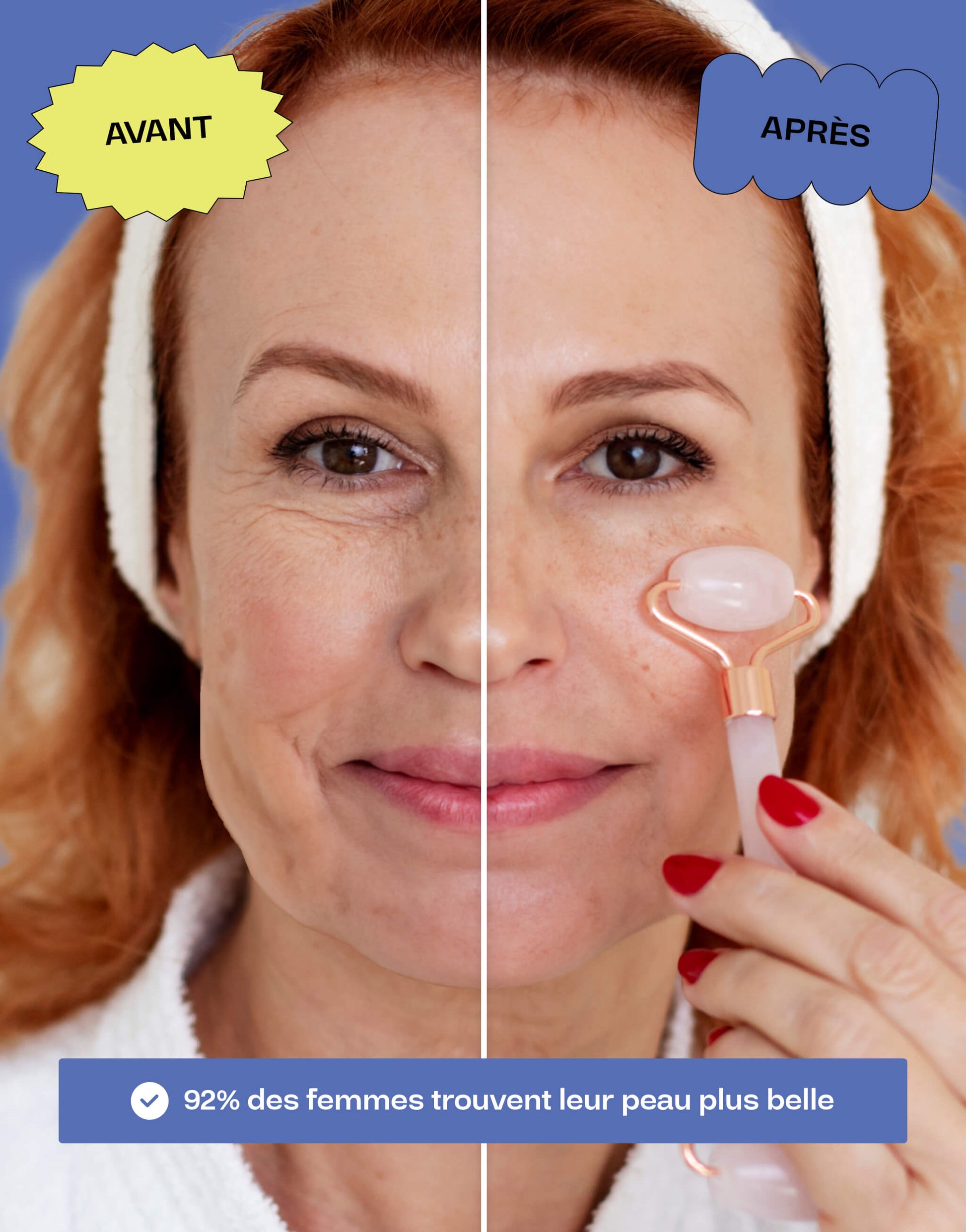 Avant et après utilisation d'un roller en quartz rose, montrant une amélioration visible de la peau, avec 92% des femmes constatant une peau plus belle.