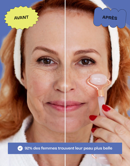Avant et après utilisation d'un roller en quartz rose, montrant une amélioration visible de la peau, avec 92% des femmes constatant une peau plus belle.